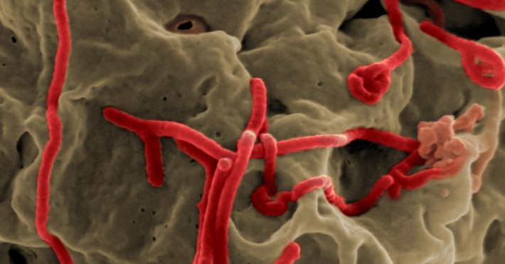 türkiyede ebola virüsü
